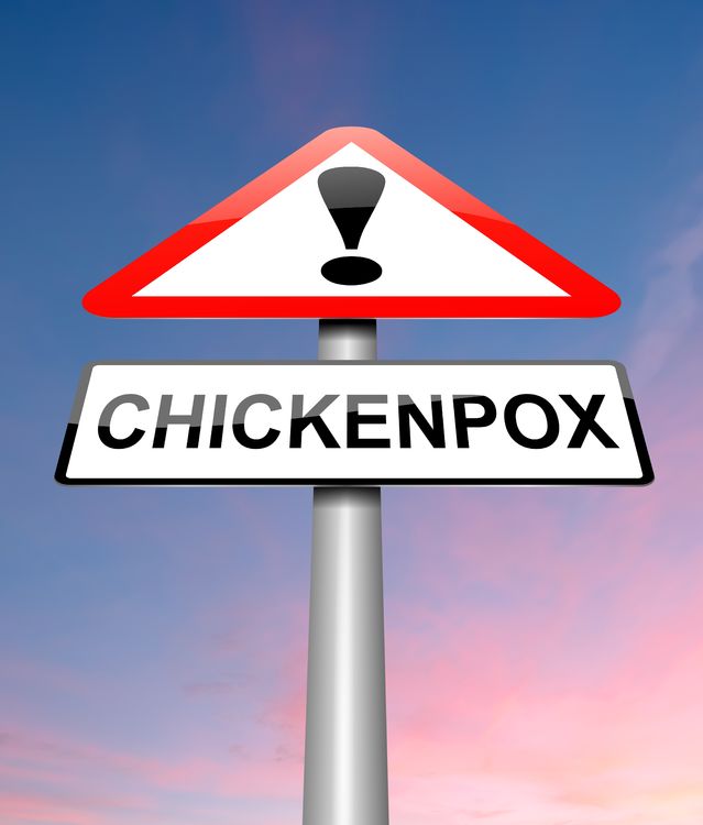 Chicken Pox Diet Chart